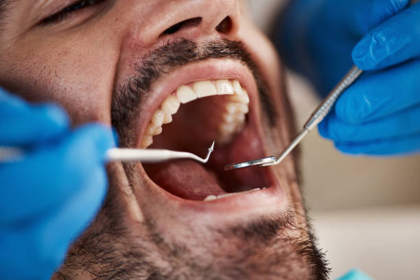 Best Emergency Dental Services for Seniors in Fairmont, NC